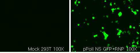 Transfection된 세포주로부터 GFP 발현 여부 확인