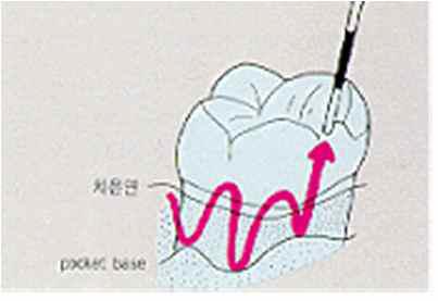 walking probing method