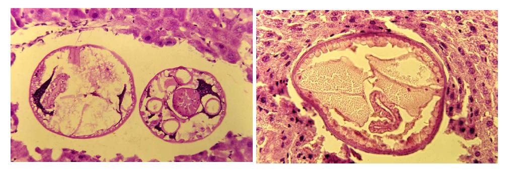 Cross sectional findings of the advanced third stage larva of Gnathostoma hispidum collected from a snake host, Agkistrodon brevicaudus.