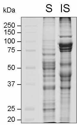 SDS-PAGE analysis of soluble (S) and insoluble fractions of G. nipponicum. Molecular size markers are marked in the left.