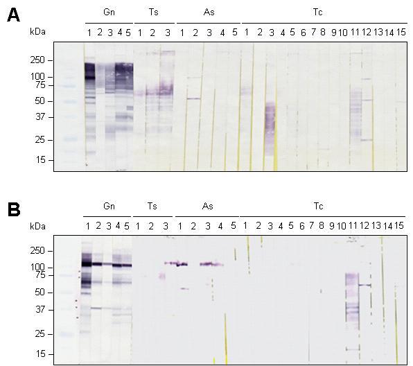 Cross reactivity test. The soluble fraction (A) and insoluble fraction (B) of G. nipponicum lysate were separated by SDS-PAGE and transferred onto nitrocellulose membrane, respectively. The membranes were cut into strips and each strip was incubated in 1:150 diluted srea from Gnathostoma infected individuals (Gn; n=5), Trichinella spiralis (Ts; n=3), Anisakis simplex (As; n=5) or Toxocara canis (Tc; n=15). After three times washing with PBST, the strips were probed 1:1000 diluted HRP-conjugated anti-human IgG and developed with 4CN.