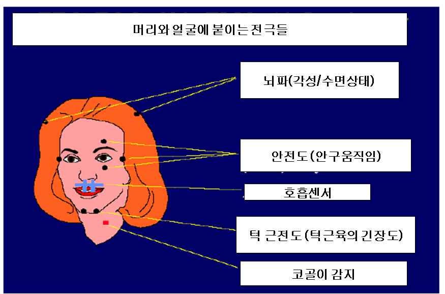 그림 5. 수면다원검사 과정1: 머리와 얼굴, 목에 전극과 센서를 붙여서 뇌파, 눈동자 움직임, 호흡, 코골이를 측정한다.