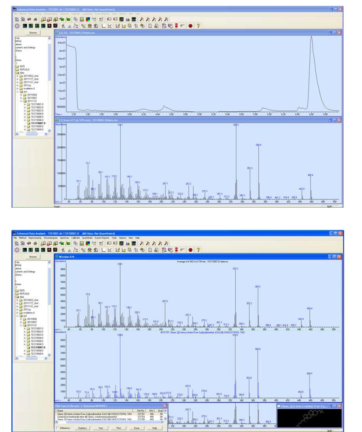 Cholesterol identification by GC-MS in Korean lipid national laboratory