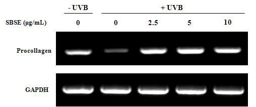 SBSE stimulated the synthesis of type I procollagen in human dermal fibroblasts