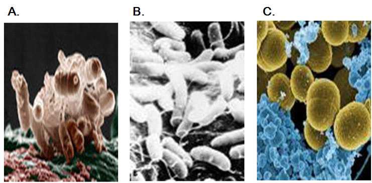 Bacteria for examination of antibacterial performance