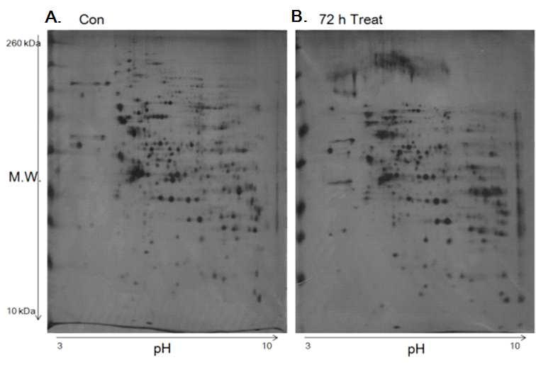 Large gel 2-DE separation of total protein lysate of AGS cells.