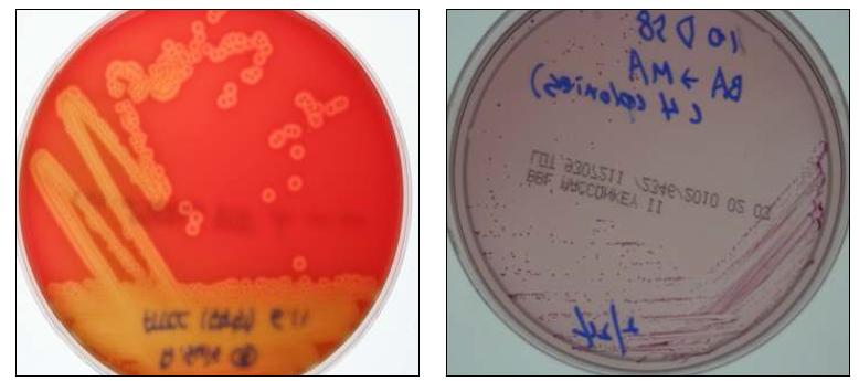 Colony patterns of A. suis on sheep blood agar incubated at 37℃, 5% CO2.