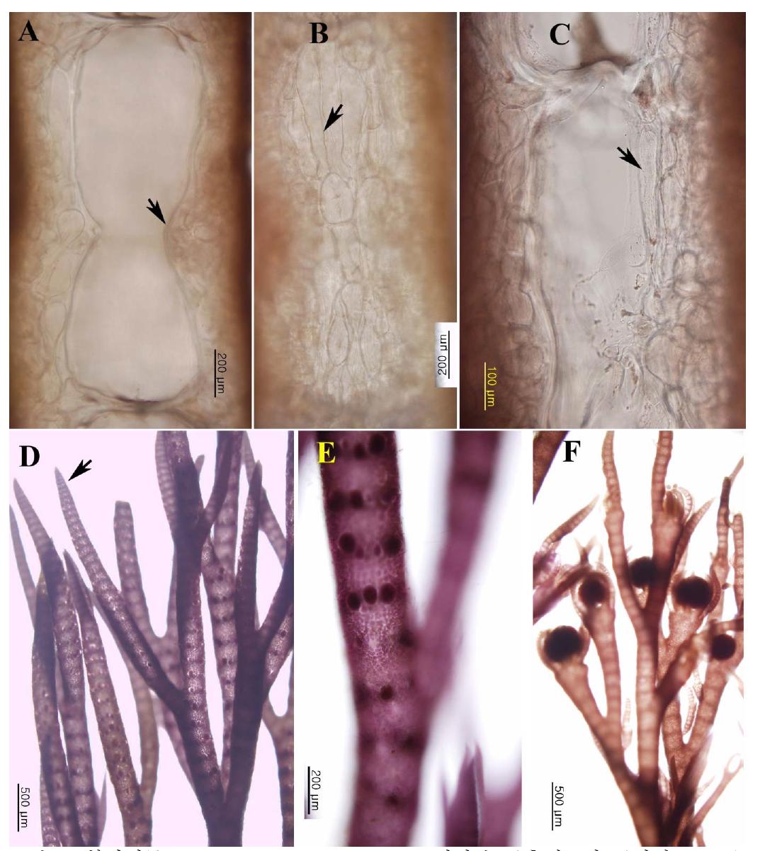 북방석묵 Campylaephora borealis.