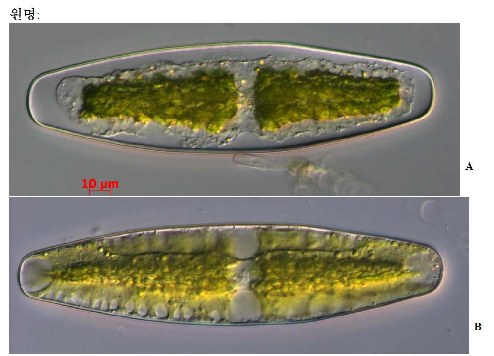 A, B. Netrium digitus