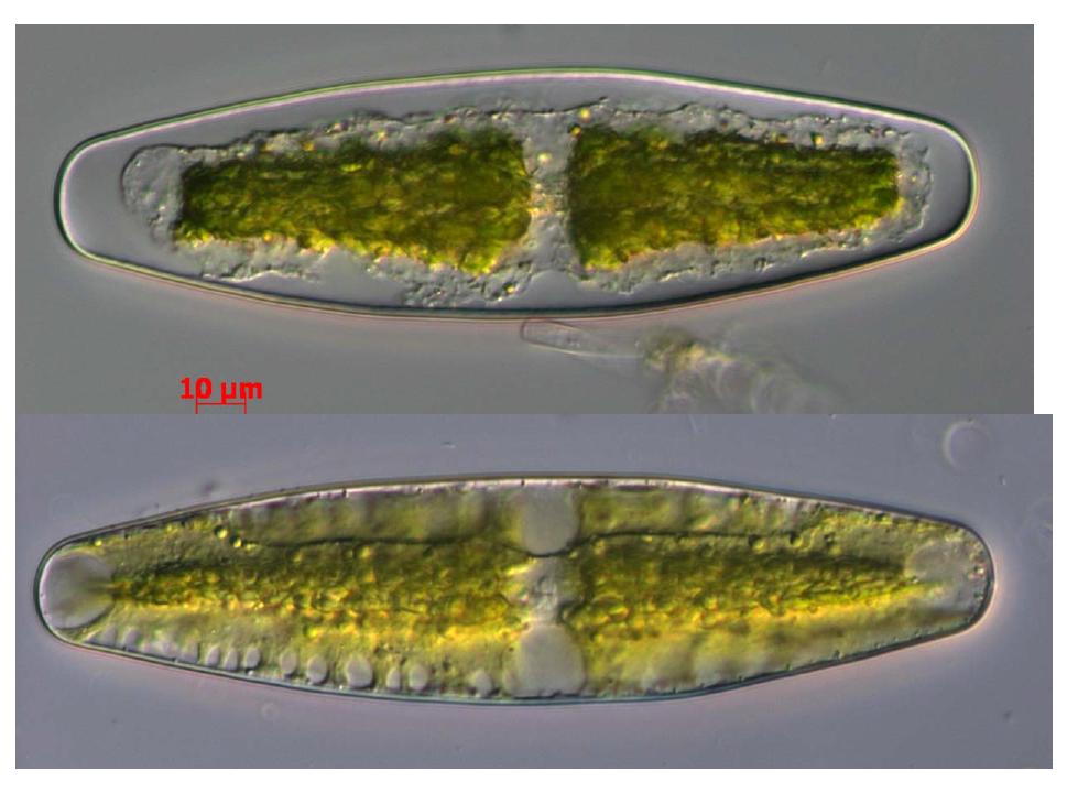 A, B. Netrium digitus