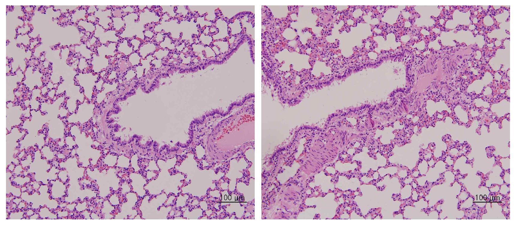 Histopathological findings of the lung in acute inhalation toxicity test.