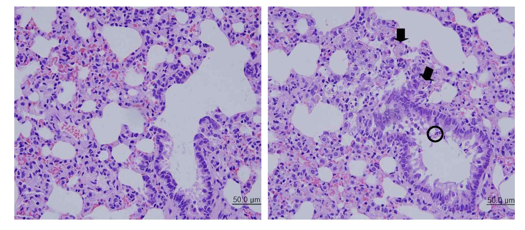 Histopathological findings of the lung in Subacute inhalation toxicity test for fly ash A..