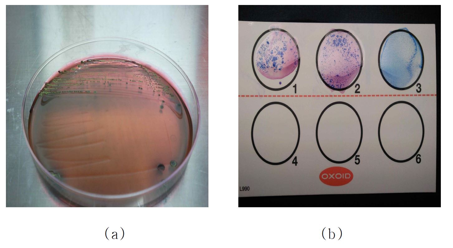 Positive result of EHEC; EHEC colony on EMB agar medium(a), positive result of EHEC in serological test(b)