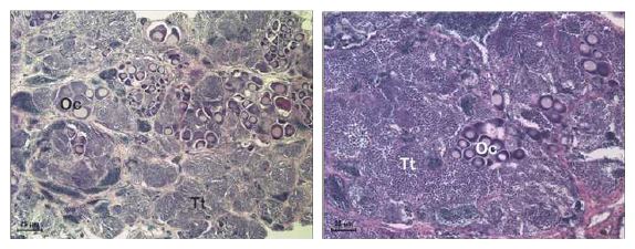 Histological change of testis(Tt) and oocyte(Oc) in male fish exposed to 100 ng/L 17β-estradiol.