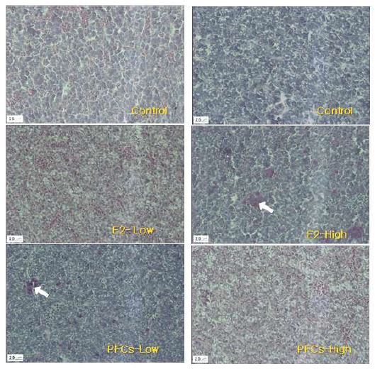 Histological change in the liver of Oryzias latipes exposed to E2 and PFCs.