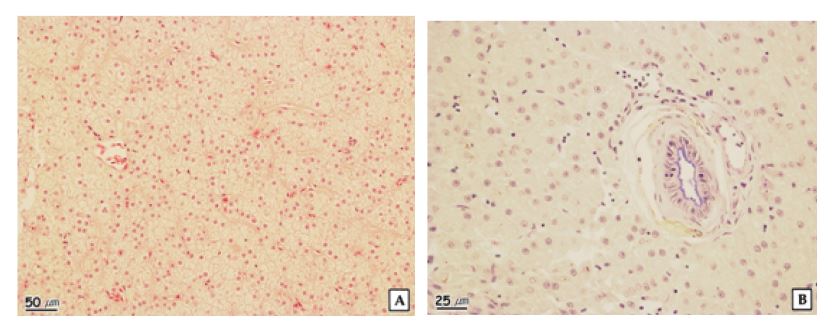 Figure 1-22. The histopathological characteristics of liver of crucian carp in the Chungju