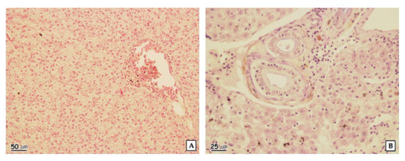 Figure 1-24. The histopathological characteristics of liver of crucian carp in the Andong