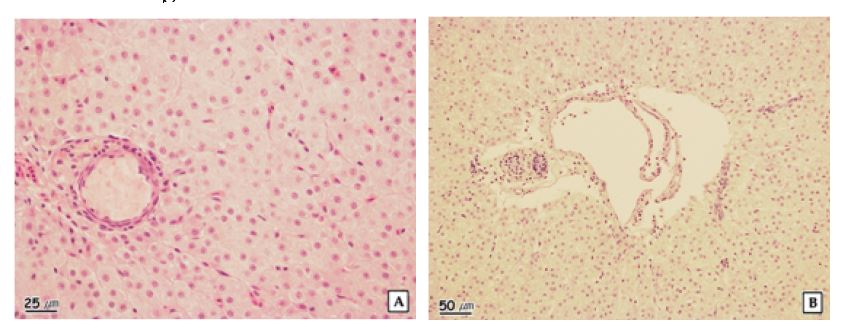 Figure 1-25. The histopathological characteristics of liver of crucian carp in the Gimhae