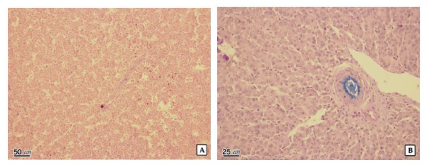 Figure 1-28. The histopathological characteristics of liver of mandarin in Bokha