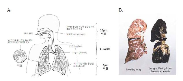 그림 1-2. 분진크기에 따른 호흡기 노출(A), 정상폐와 진폐증 폐사진(B)