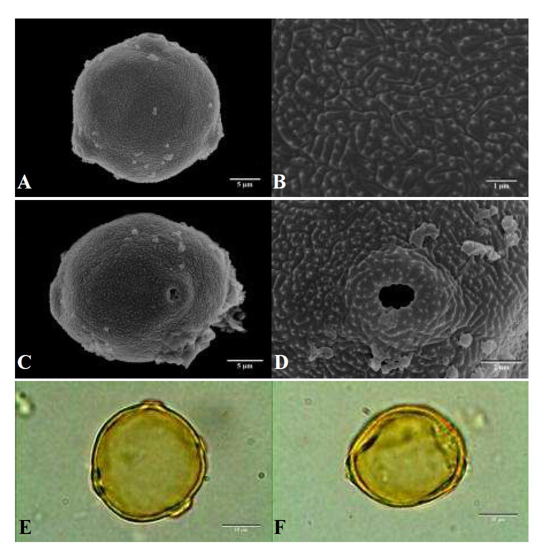 SEM and LM micrographs of pollen grains of Carpinus cordata Blume (까치박달).