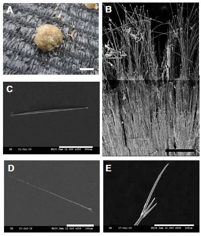 Fig. 2. Craniella n. sp. A, Entire animal; B, Skeleton; C, Oxea; D, Protriaene; E,