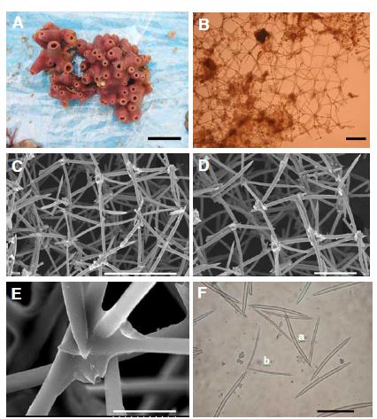 Fig. 10. Haliclona (Reniera) sinyeoensis n. sp. A, Entire animal; B, Ectosomal skeleton