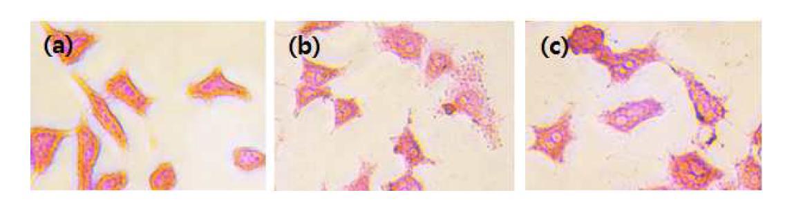 Fe3O4-APTS-cisplatin 나노입자의 나노입자 주입 농도별 prussian blue-stained Hela cells의 현미경 이미지 ( Control cell (A), 25 μg/ml concentration (B), and 50 μg/ml concentration (C))