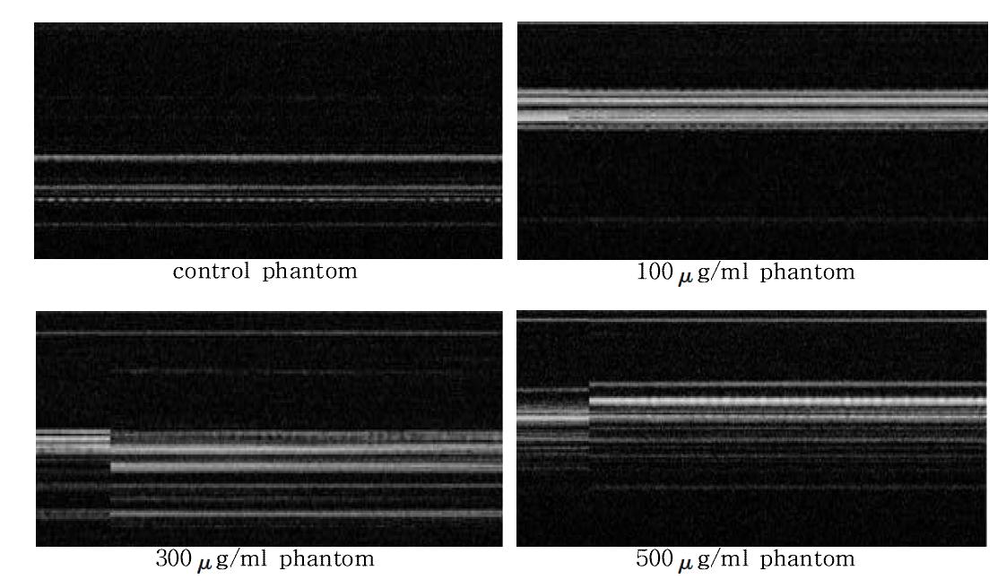 자기장을 인가했을 때 tissue phantom 에서의 초음파 도플러 신호 측정