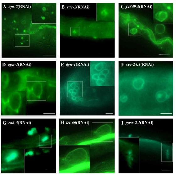 Feeding RNAi 실험 후에 GFP-ACT-5의 위치를 비정상적으로 만드는 유전자들