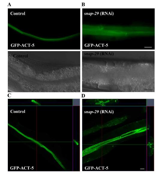 GFP-ACT-5 transgenic worm에 snap-29 RNAi를 처리한 후 변화된 GFP-ACT-5의 발현 양상