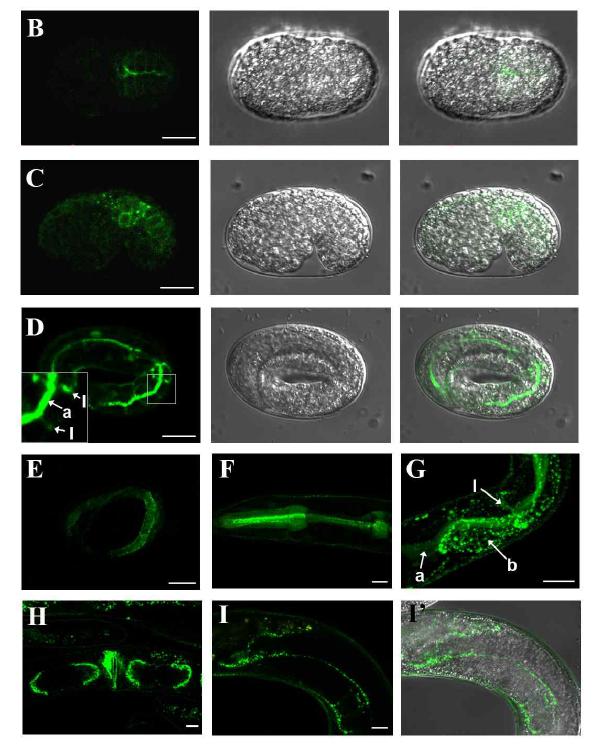 NFM-1-GFP의 표현 양상 관찰 결과로 embryo에서 adult에 이르기까지 다양한 상피조직의 membrane에서 발현함을 알 수 있다.