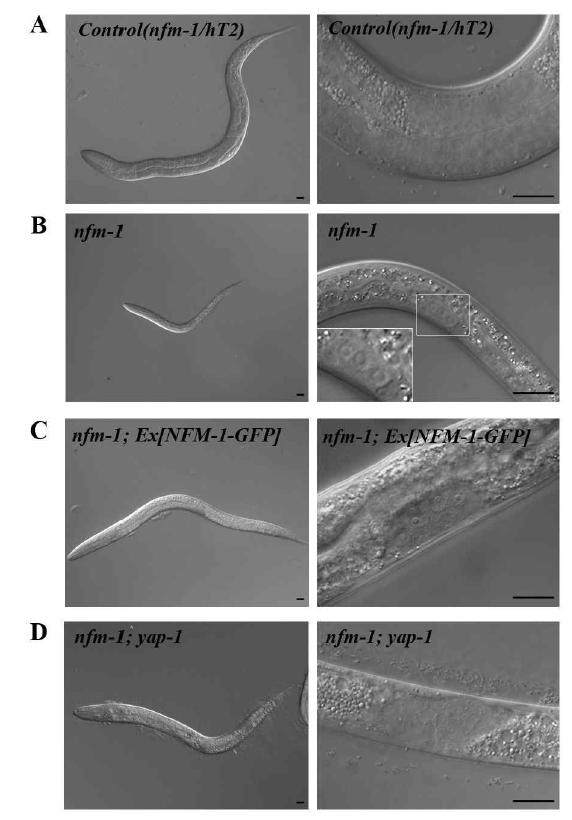 nfm-1;yap-1 돌연변이의 표현형질 관찰결과