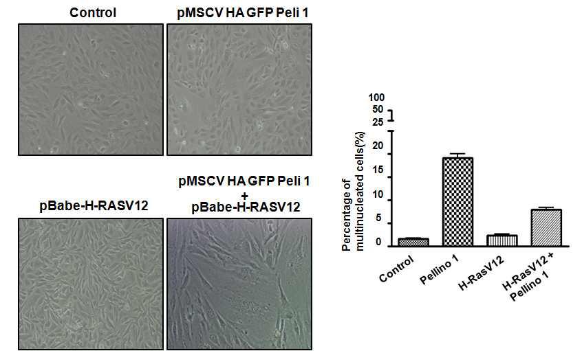 MEF에서 Pellino 1의 과발현에 의한 multinucleated 관찰