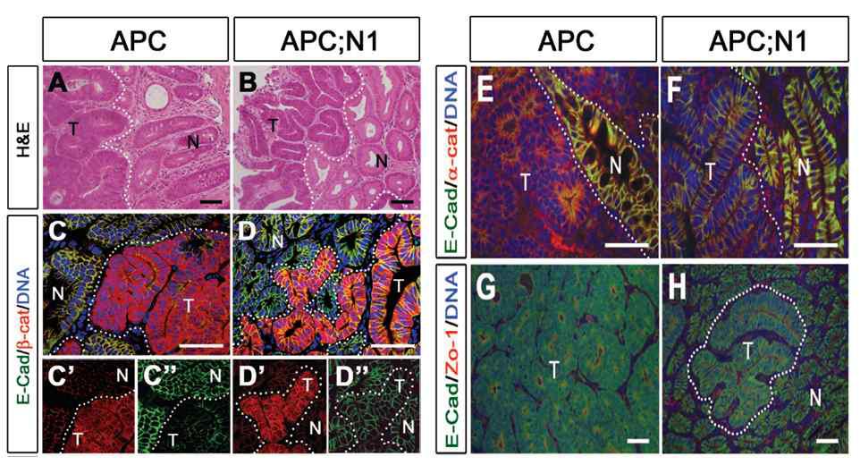 APC;N1 생쥐의 조직학적 분석.