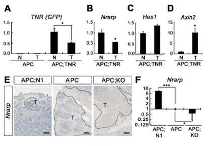 (A) APC 생쥐와 APC;TNR 생쥐의 tomor 조직 및 정상 조직에서의 GFP 발현조사 (B-D) 정상조직과 tumor 조직에서 Nrarp, Hes1, Axin2 발현조사 (E, F) APC, APF;N1, APC;KO 마우스에서 Nrarp 발현 조사. (G-H) 인간 대장암 진행과정 동안 NRARP 발현 조사