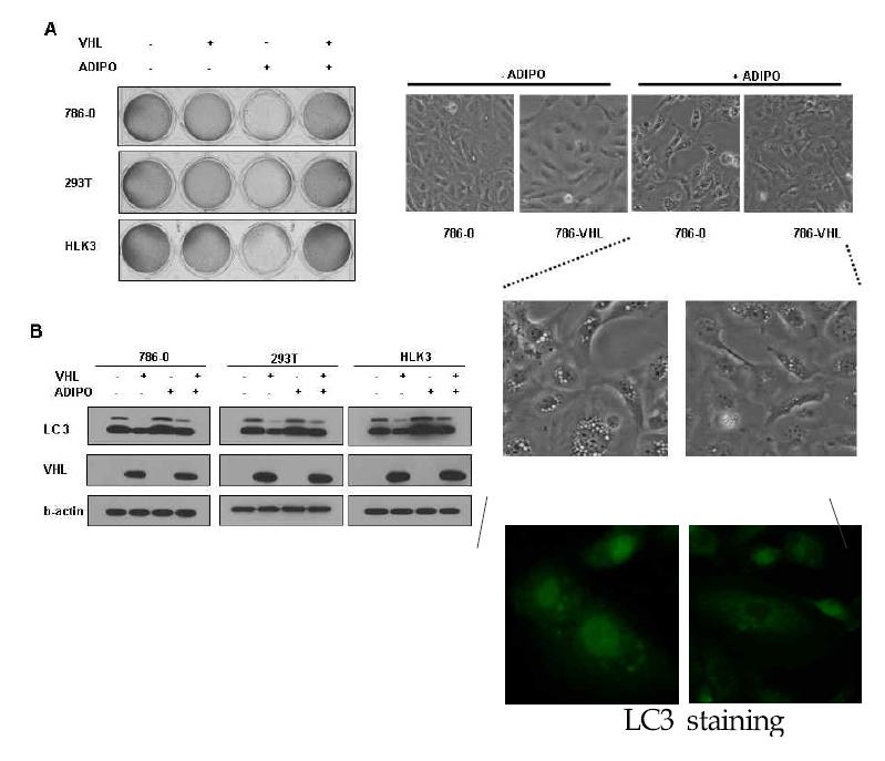 지방대사 이상에 의한 autophagic cell death 유도와 이를 억제하는 pVHL의 기능 검증