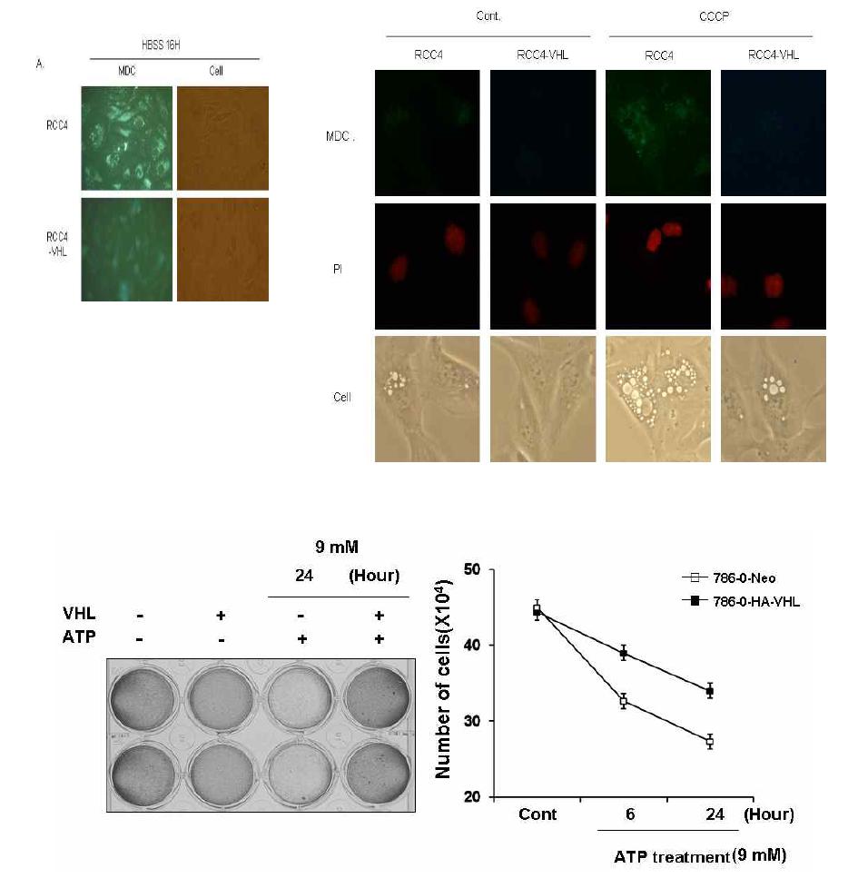 미토콘드리아 기능이상을 유발에 의한 VHL의 autophagic cell death 감소 효과