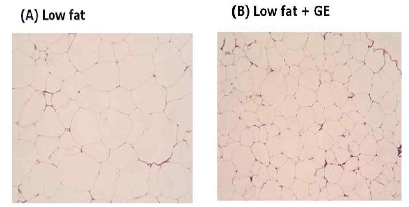 Light microscopy of white adipose tissues stained with hematoxylin and eosin (original magnification X 100).