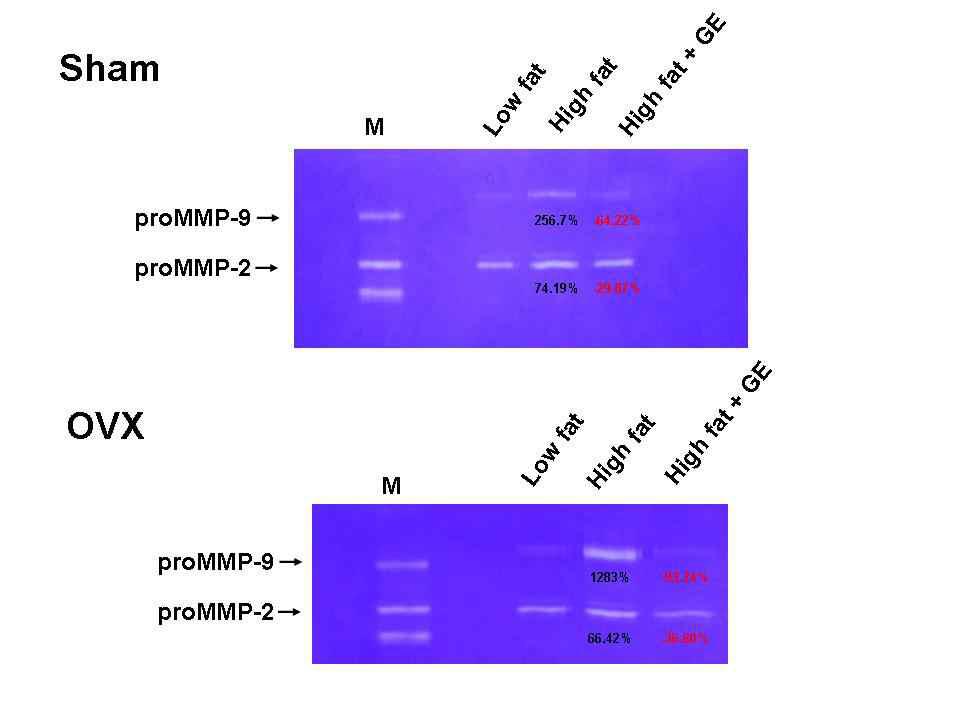 Zymographic analysis of visceral adipose tissue.