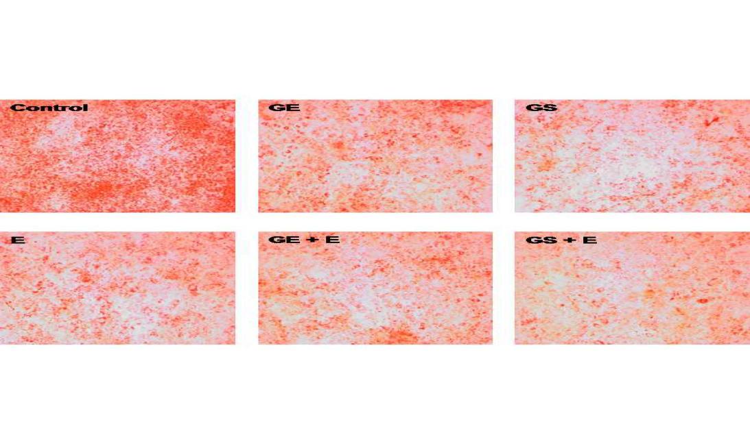 Effects of 17β-estradiol on ginseng-inhibited triglyceride accumulation in 3T3-L1 cells.