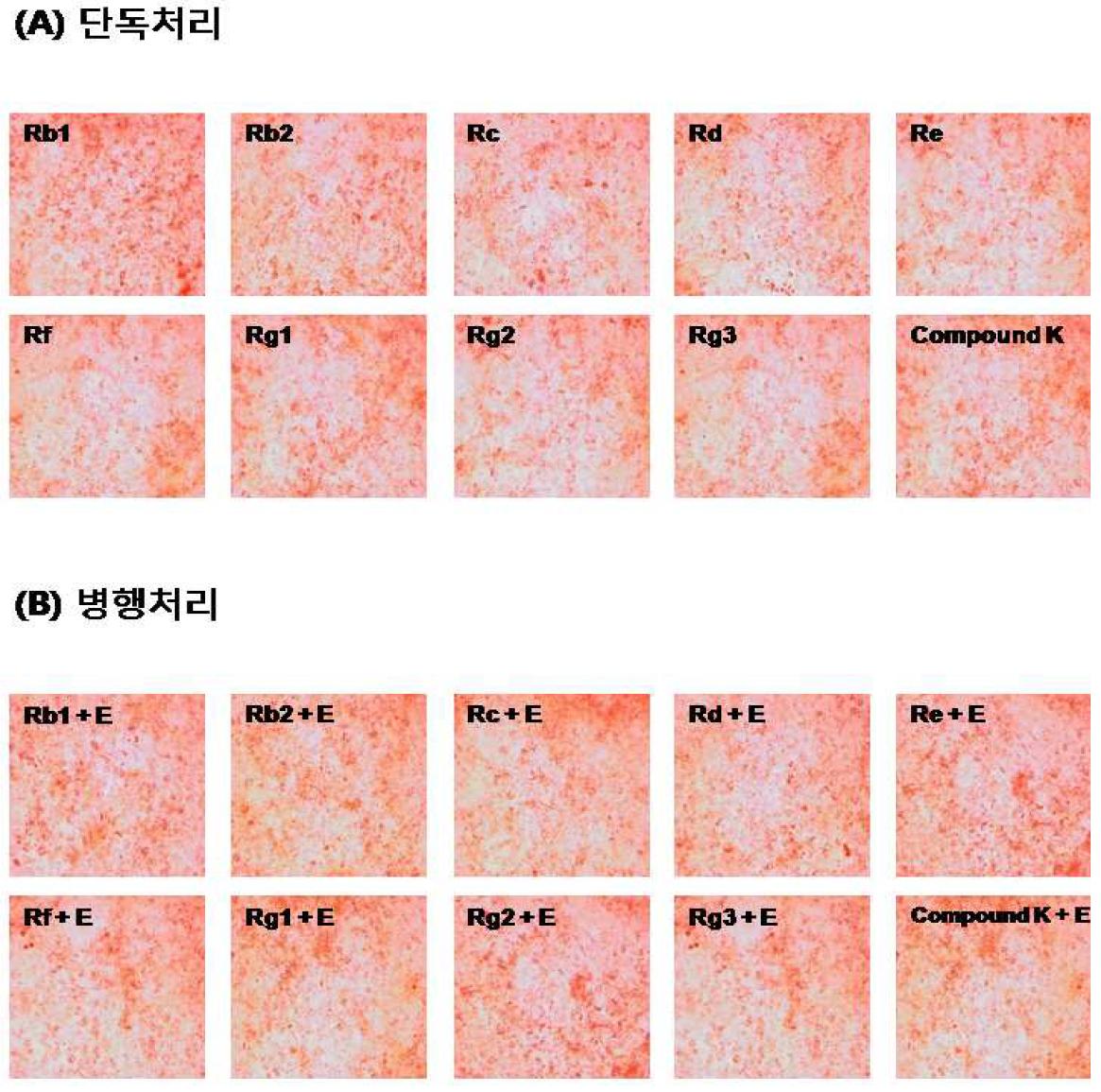 Effects of 17β-estradiol on ginsenosides-inhibited triglyceride accumulation in 3T3-L1 cells.