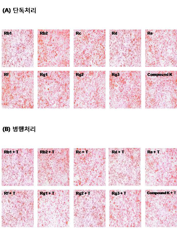 Effects of testosterone on ginsenosides-inhibited triglyceride accumulation in 3T3-L1 cells.