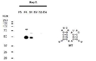 폴리콤 복합체의 EZH2 의 RepA noncodingRNA 와의 결합 도메인 동정