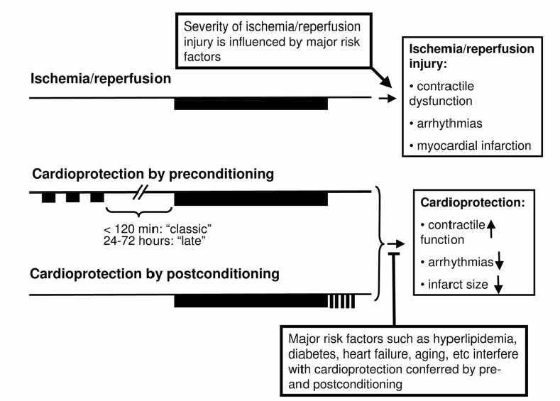 재관류 손상을 막기 위한 preconditioning과 postconditioning