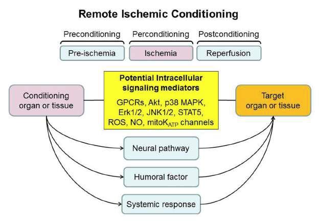 Remote Ischemic Conditiong