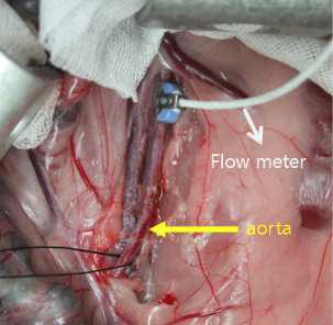 토끼 대동맥 박리 후 flowmeter probe를 거치시킴