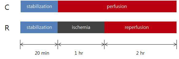 허혈 및 재관류 시간