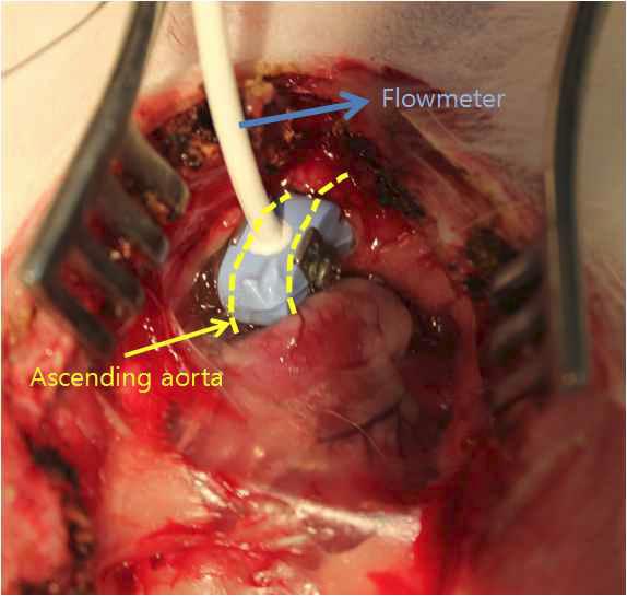 심박출량 측정을 위해 상행대동맥에 flowmeter 거치