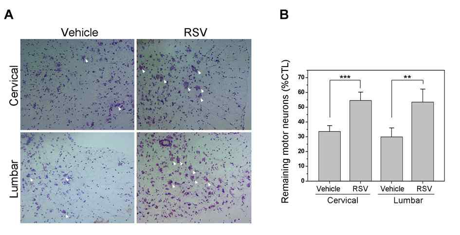 RSV에 의한 G93A 생쥐의 척수 운동신경세포 보호